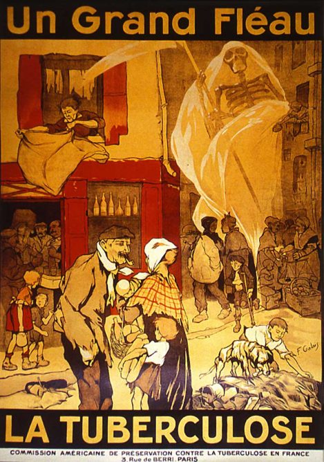 tuberculose- santé étudiant