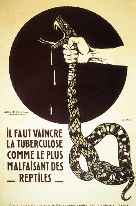 tuberculose - santé étudiant