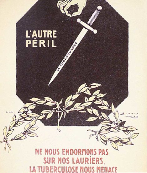 tuberculose - santé étudiant