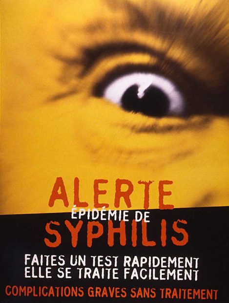 syphilis complications graves sans traitement - santé étudiant